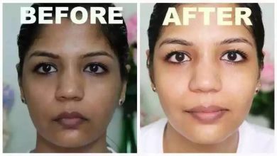 15 Best Bleaching Cream in Nigeria without Side Effect