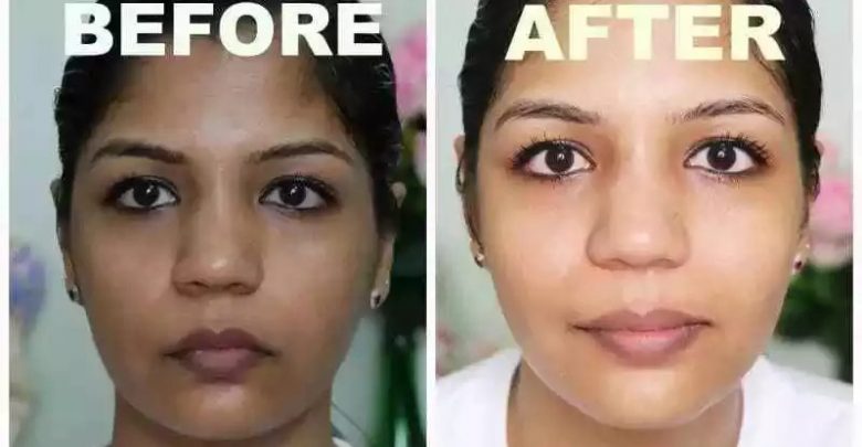 15 Best Bleaching Cream in Nigeria without Side Effect