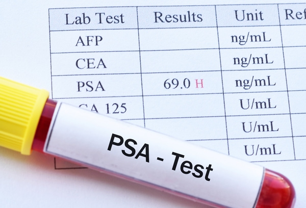 Cost of PSA Test in Nigeria