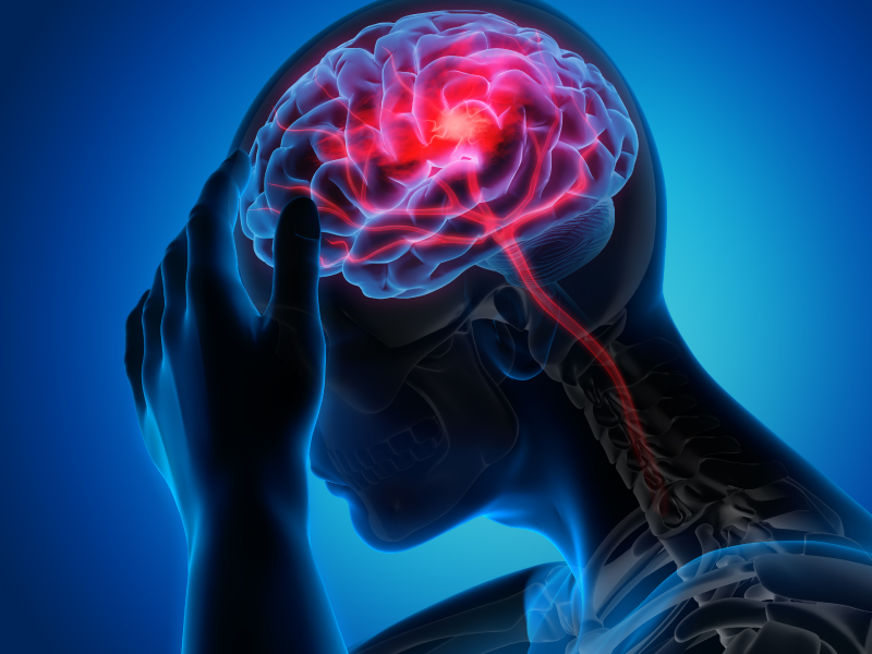 Top 15 Hospitals for stroke patients in Nigeria