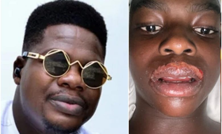 ‘Football Injuries Don’t Cause That Much Pain’ – Mr Macaroni Reacts To Photo Of 12-Year-Old Boy Allegedly Beaten To Death