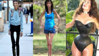 Thinnest woman in the world - 3 impressive stories