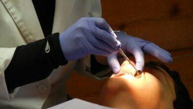 How to Study dentistry in Switzerland from Nigeria