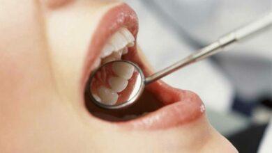 Oral cancer kills 700 Nigerians yearly