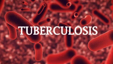 Anambra has greater number of children with TB: Personnel