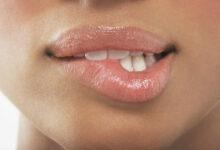 15 Best Pink Lips Balms in Nigeria