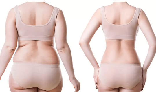 Top 15 Hospital for Liposuction in Nigeria