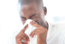 Best Natural Cures for Catarrh in Nigeria