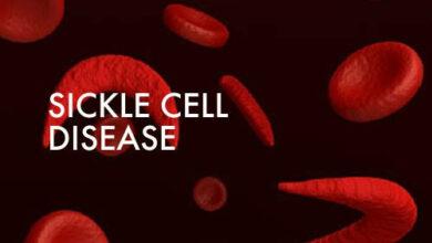 Reason sickle cell is not a death sentence — SCFN