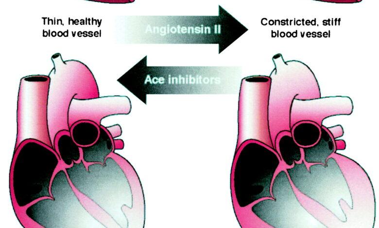 Top 15 Angiotensin-Converting Enzyme (ACE) Inhibitors