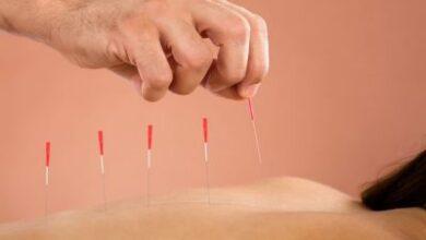 15 Major Functions of Acupuncture in Nigeria