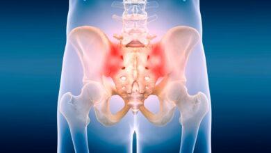 Signs and Effect of Sacroiliac Joint Dysfunction