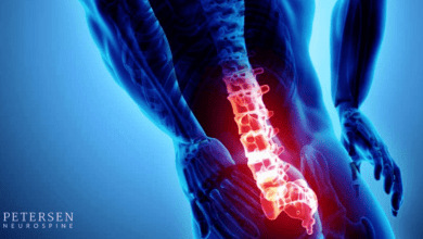 Top 15 Signs of Spinal Stenosis