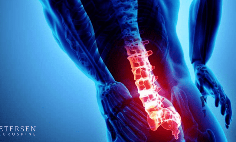 Top 15 Signs of Spinal Stenosis