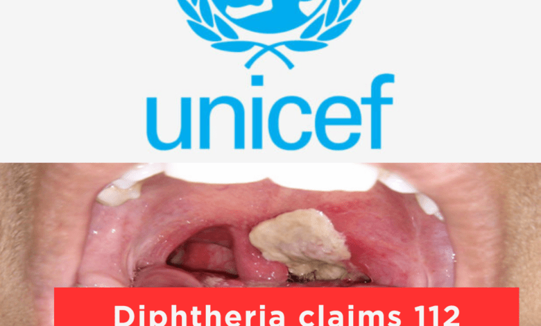 UNICEF: Diphtheria Kills 122 In Nigeria