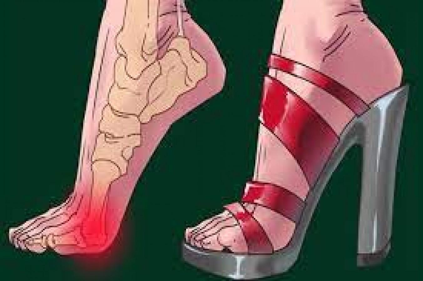 10 Disadvantages of Wearing Heels